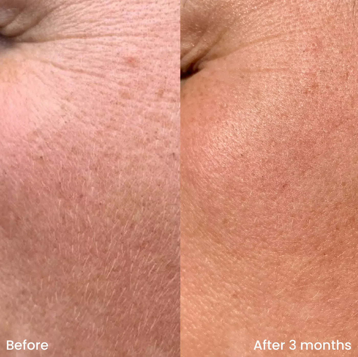 Bioactief Jelly Serum met Prebiotica