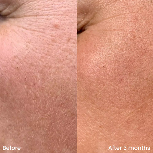 Bioactief Jelly Serum met Prebiotica
